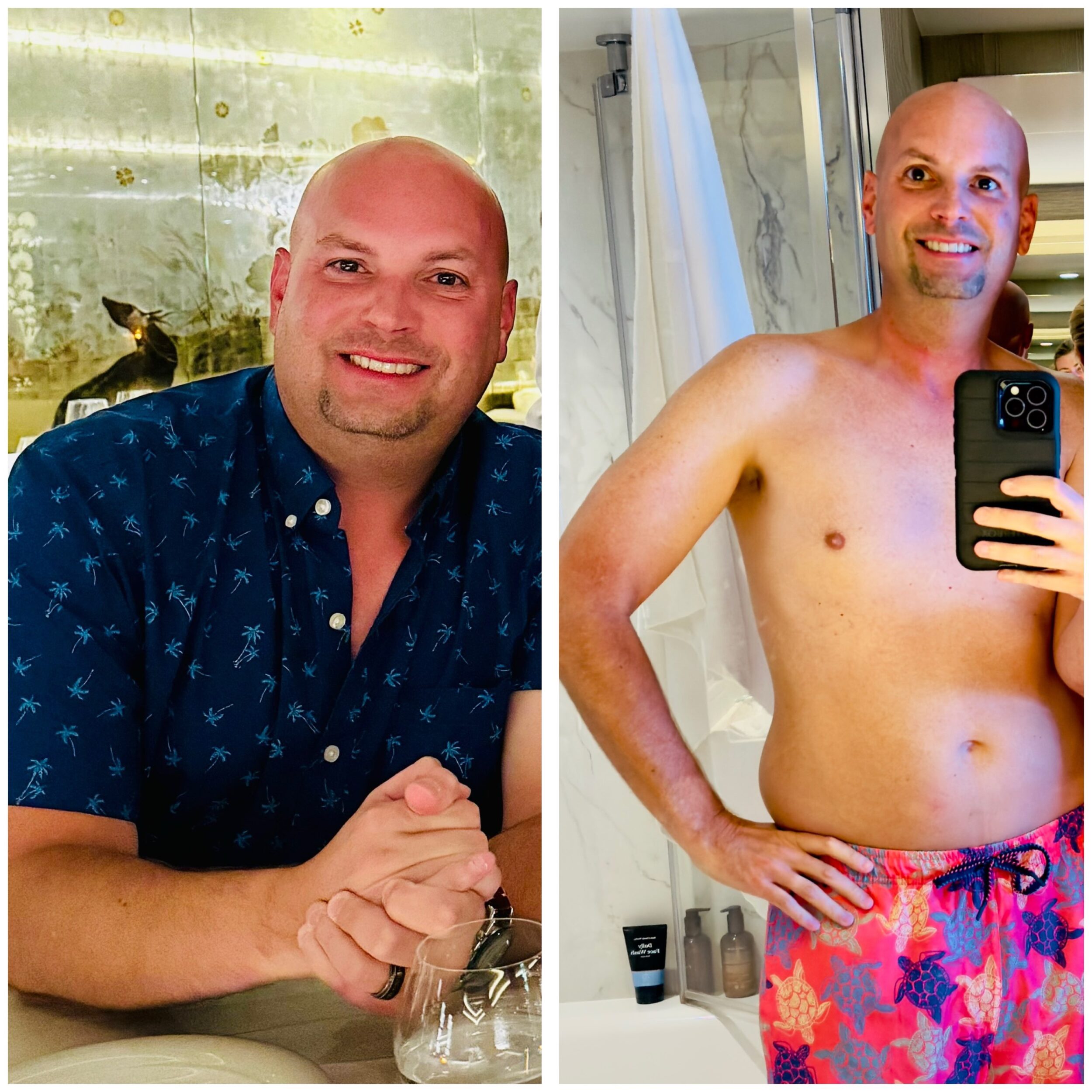 Before and After Image: Weight Loss - front