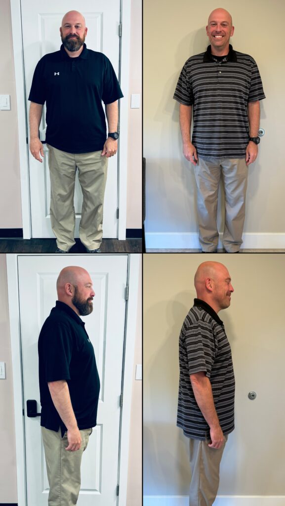 Before and After Image: Weight Loss - front