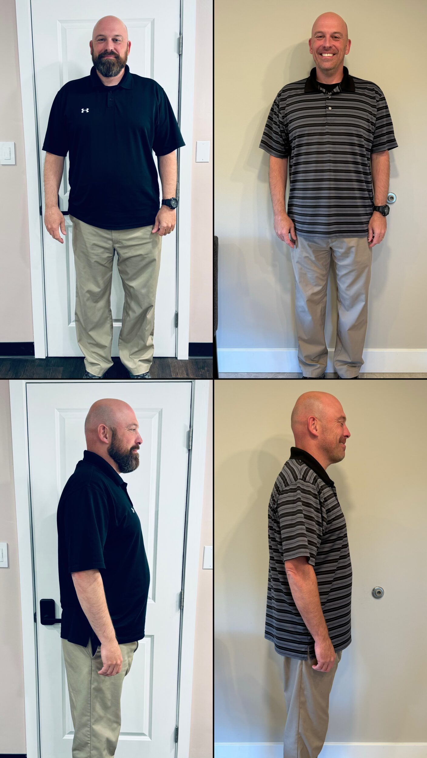 Before and After Image: Weight Loss - front
