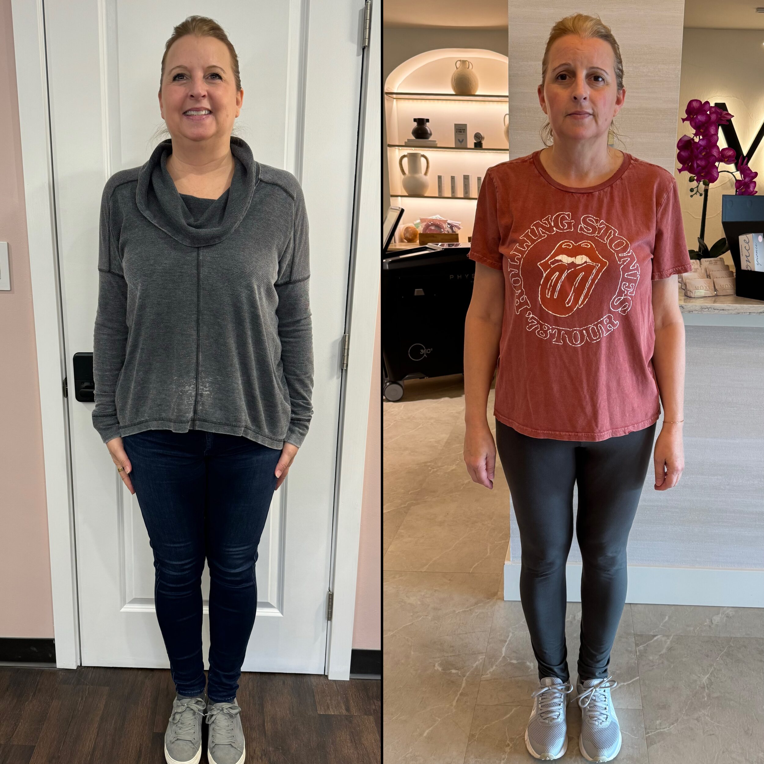 Before and After Image: Weight Loss - front