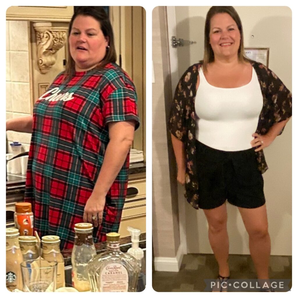 Before and After Image: Weight Loss - other