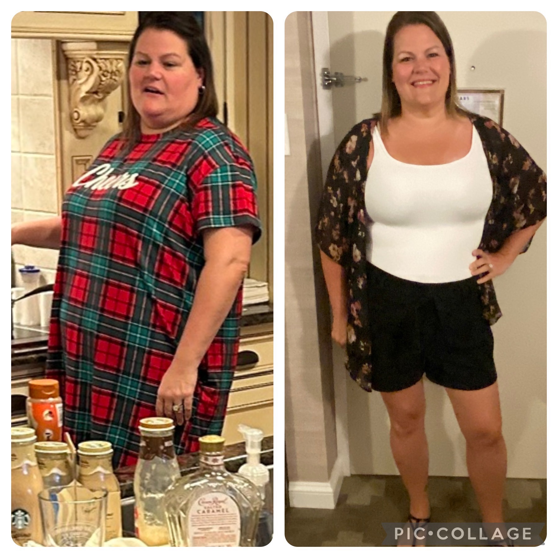 Before and After Image: Weight Loss - other