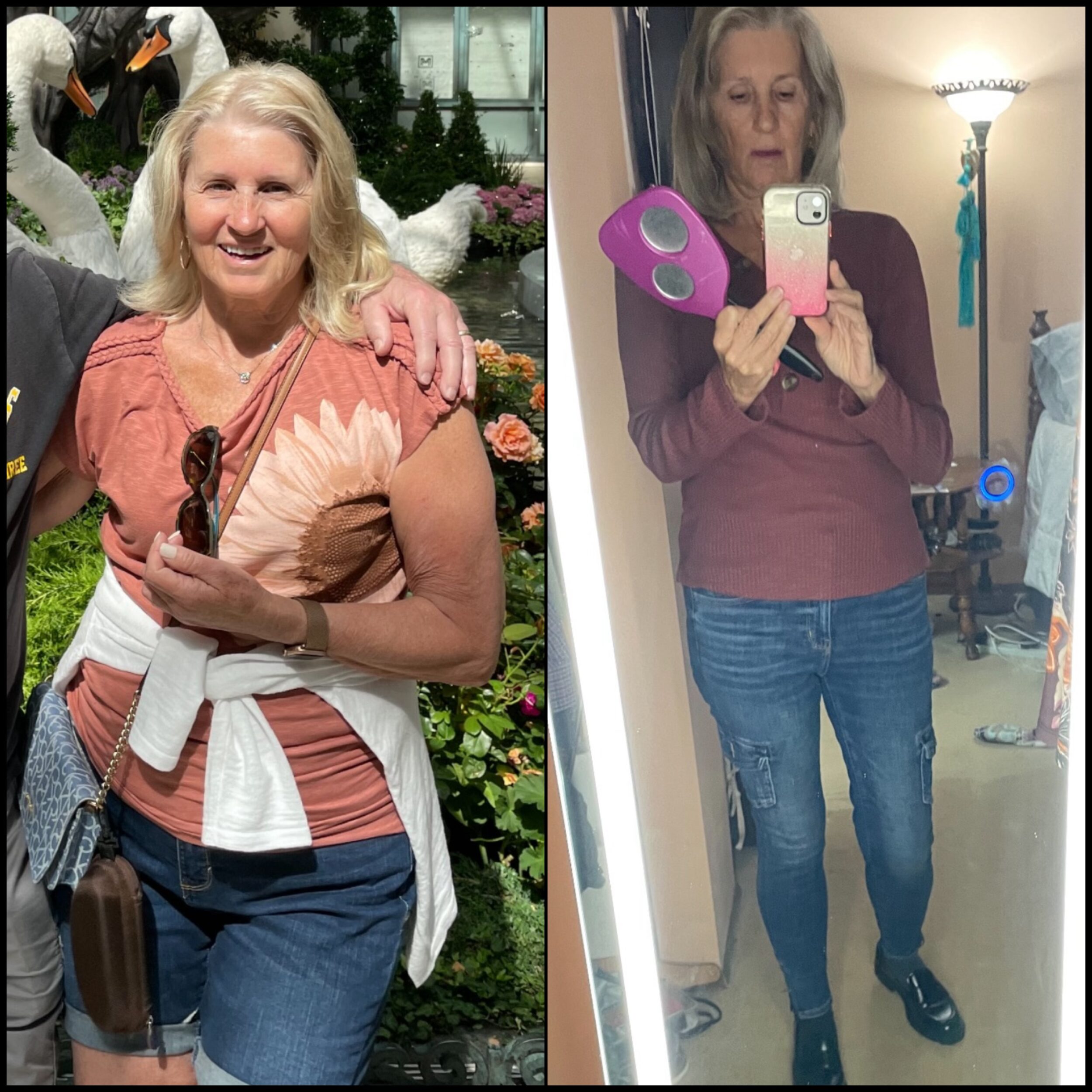 Before and After Image: Weight Loss - front