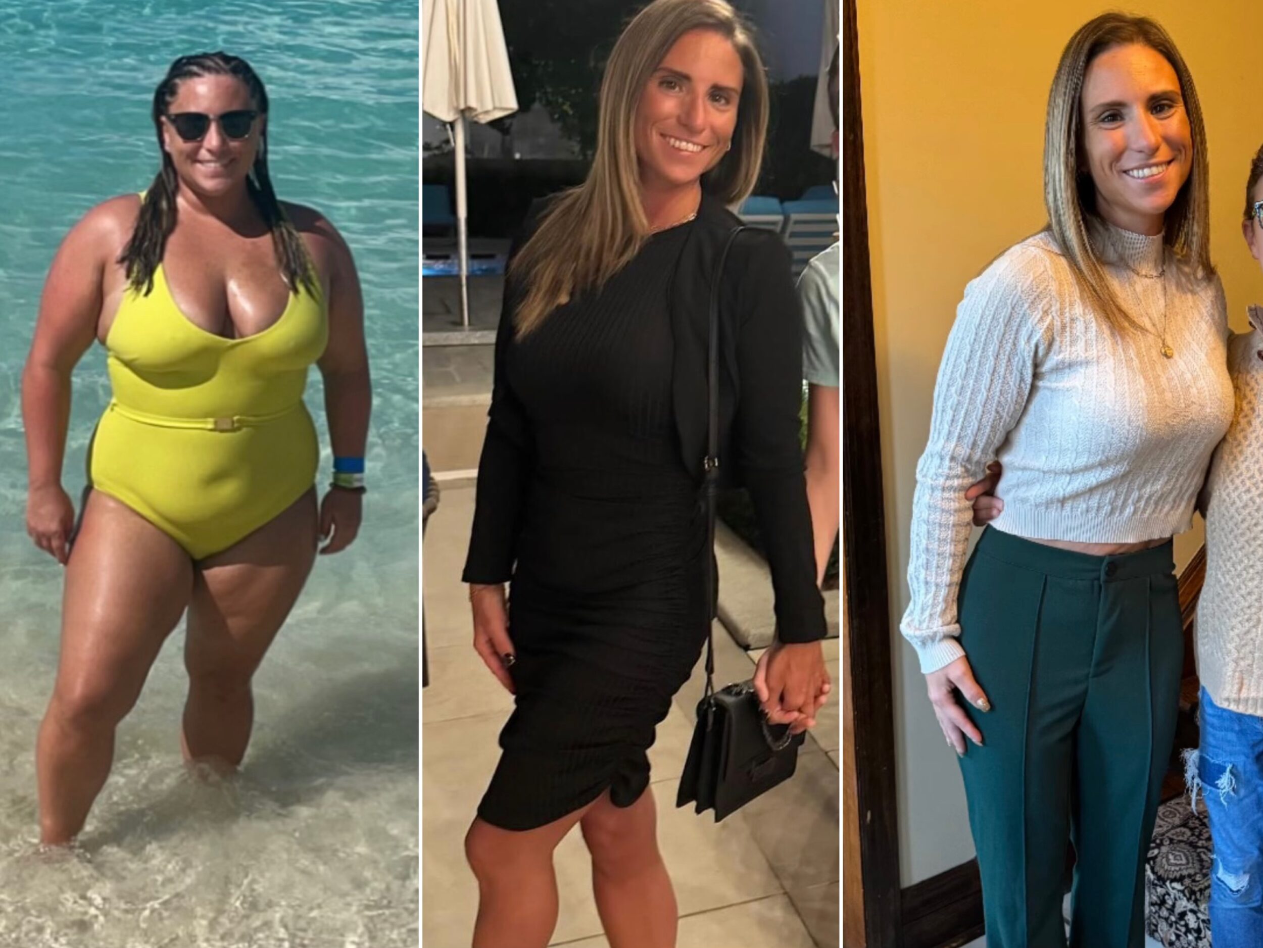 Before and After Image: Weight Loss - front